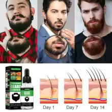 Beard Growth Oil 30ml – Estimula y Fortalece tu Barba
